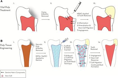 Epigenetic Approaches to the Treatment of Dental Pulp Inflammation and Repair: Opportunities and Obstacles